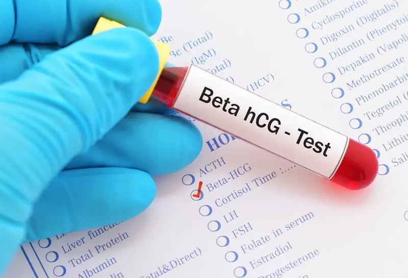 Beta hCG - Test | Frozen Embryo Transfer