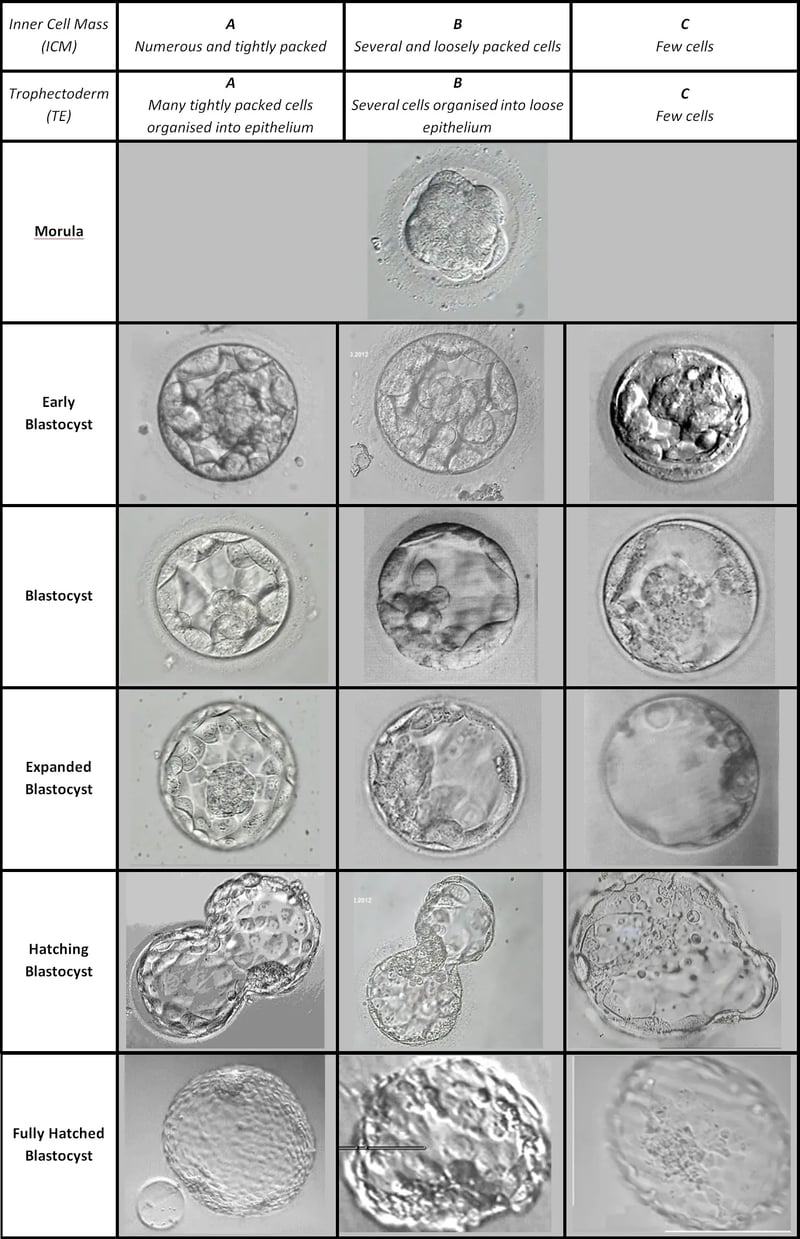 embryo grading