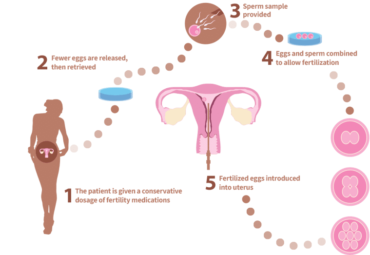 how mini IVF works - graphic