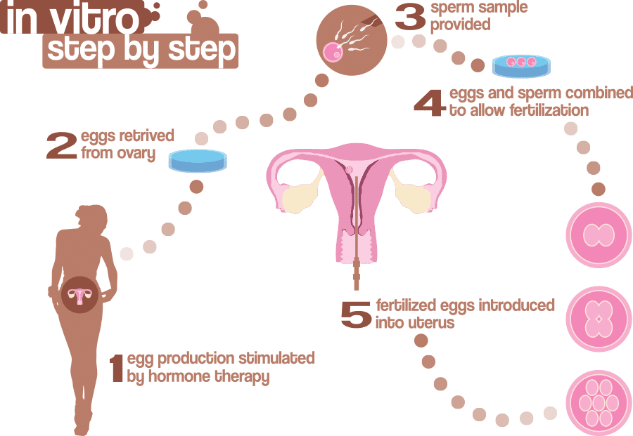 Los Angeles IVF Treatment | In Vitro Fertilization Treatment | PFCLA